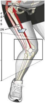 ACL Injury