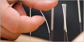 Medical Acupuncture in Toronto